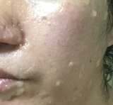 口コミ:モニプラ×クオニス メルティングエッセンスマスクの画像(4枚目)