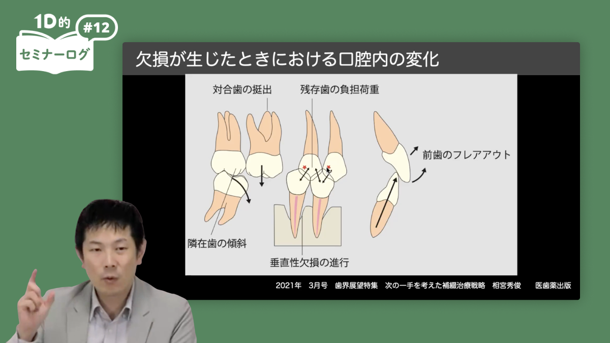 咬合再構成｜歯科オンラインセミナー・録画配信は1D（ワンディー）