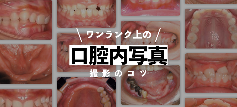 新口腔内写真の撮り方第2版 新口腔内写真の撮り方第2版 | 熊谷 崇, 熊谷 ふじ子, 鈴木 昇一