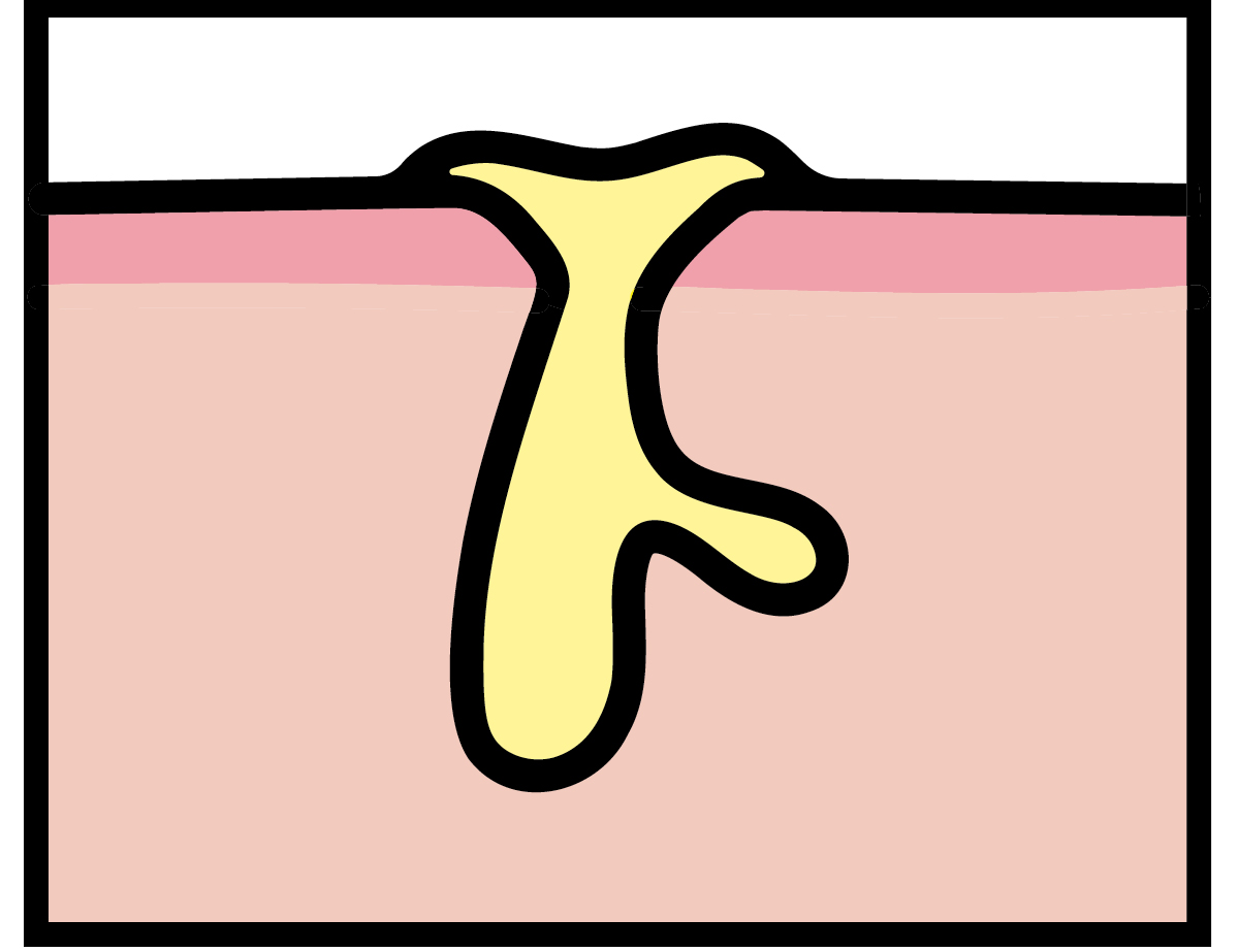 【悩み別】毛穴を目立たなくする方法 PhotoGallery_1_1