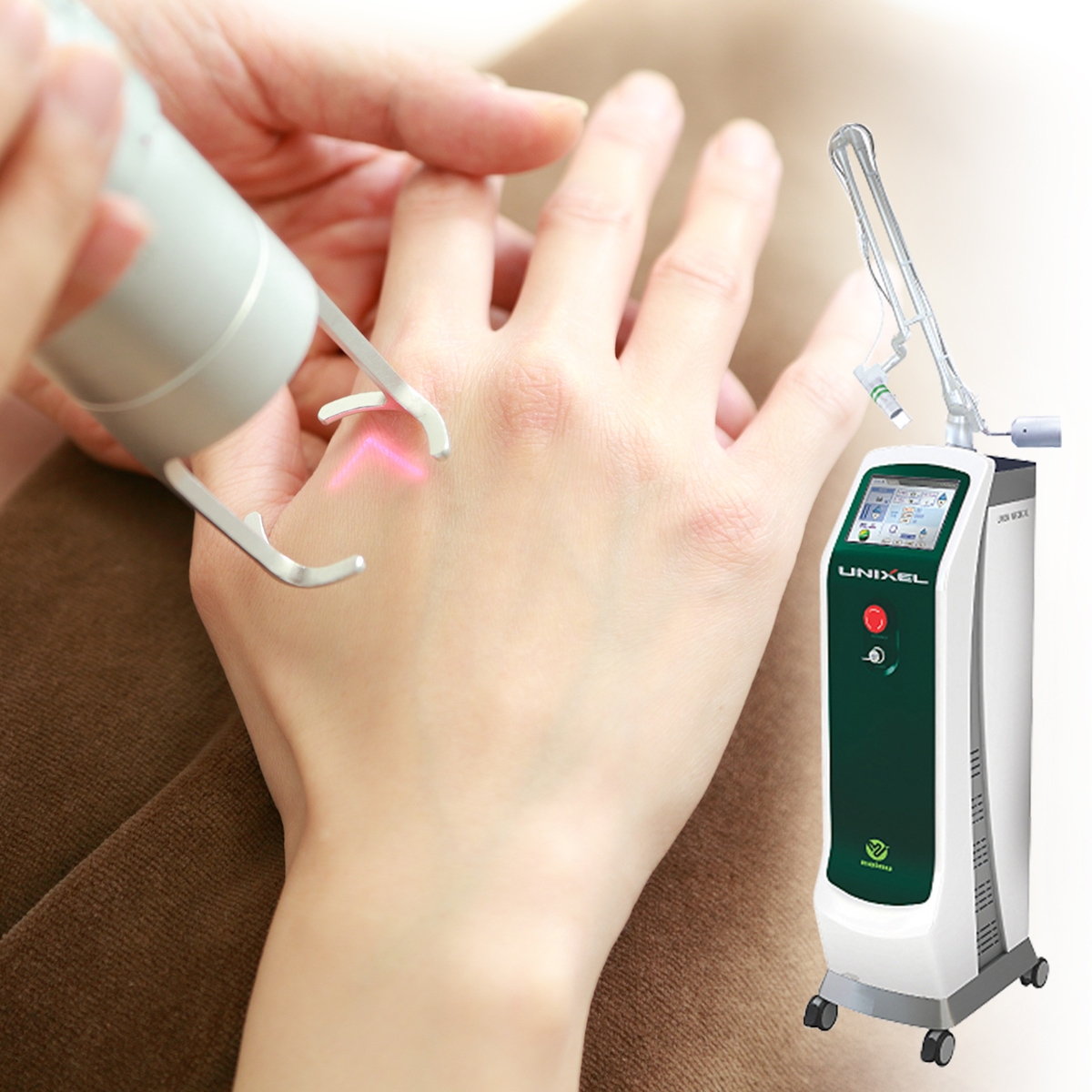 フラクショナルCO2レーザー