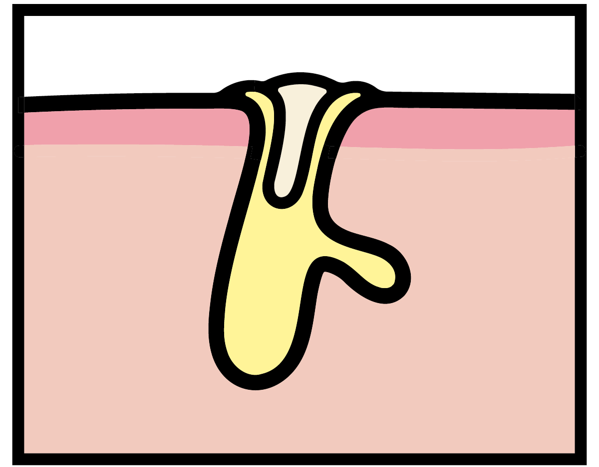 【悩み別】毛穴を目立たなくする方法 PhotoGallery_1_1