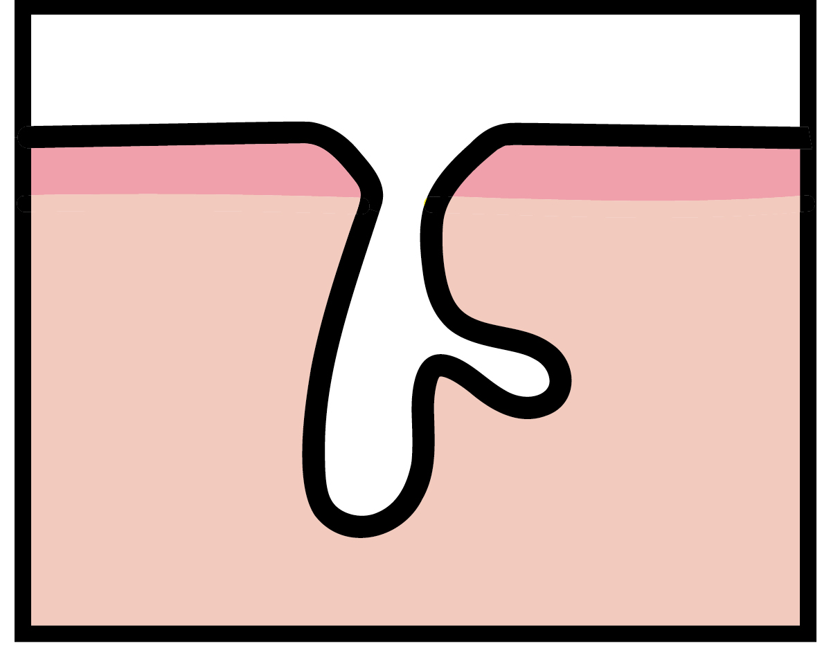 【悩み別】毛穴を目立たなくする方法 PhotoGallery_1_1