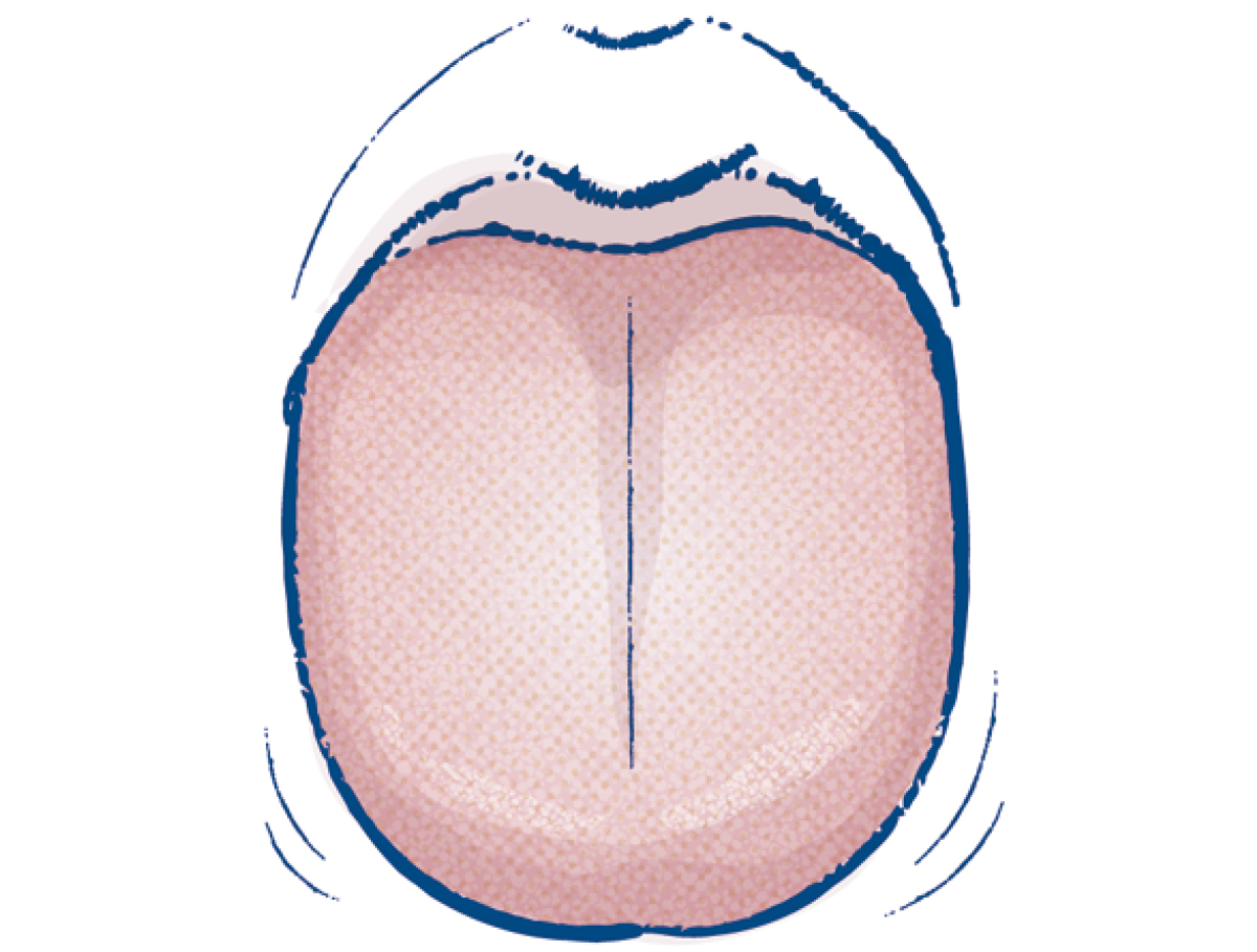 目指せ、日々快調！湿気とのつき合い方 PhotoGallery_1_1