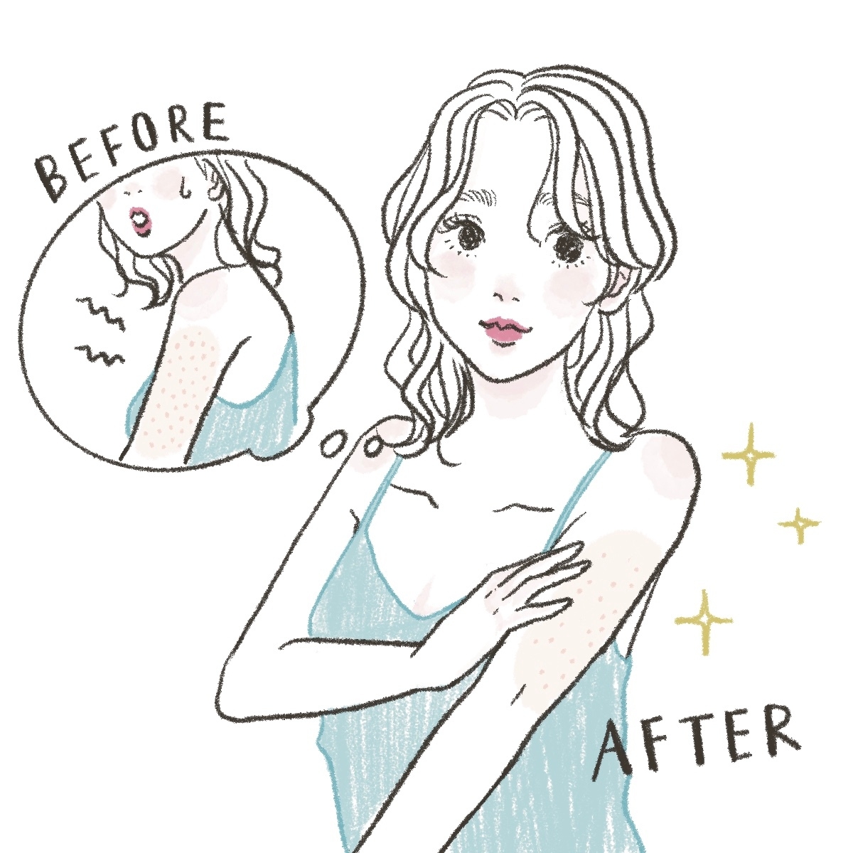 しぶとい「毛孔性苔癬」の対処＆治療法GALLERY_1_1