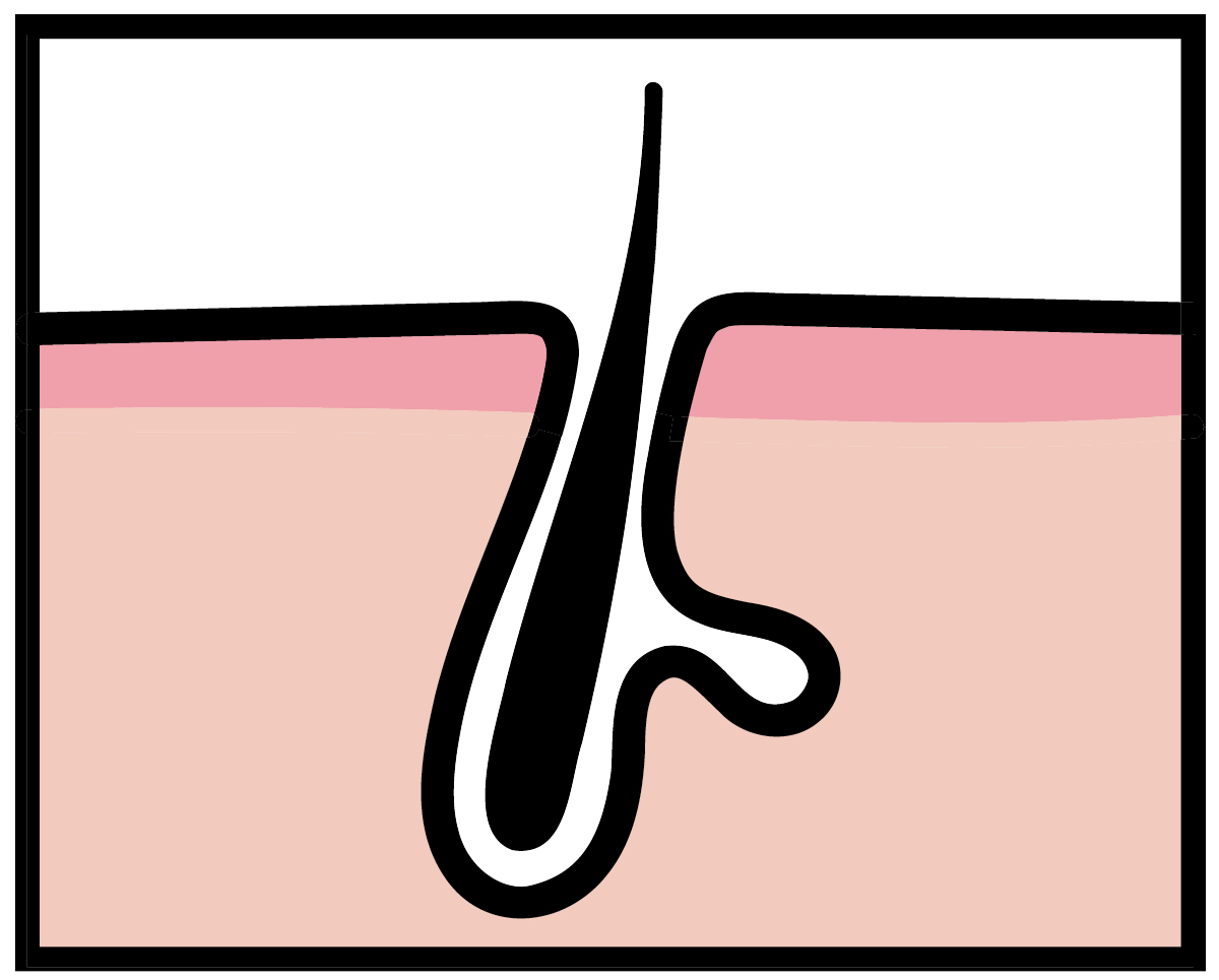 【悩み別】毛穴を目立たなくする方法 PhotoGallery_1_1