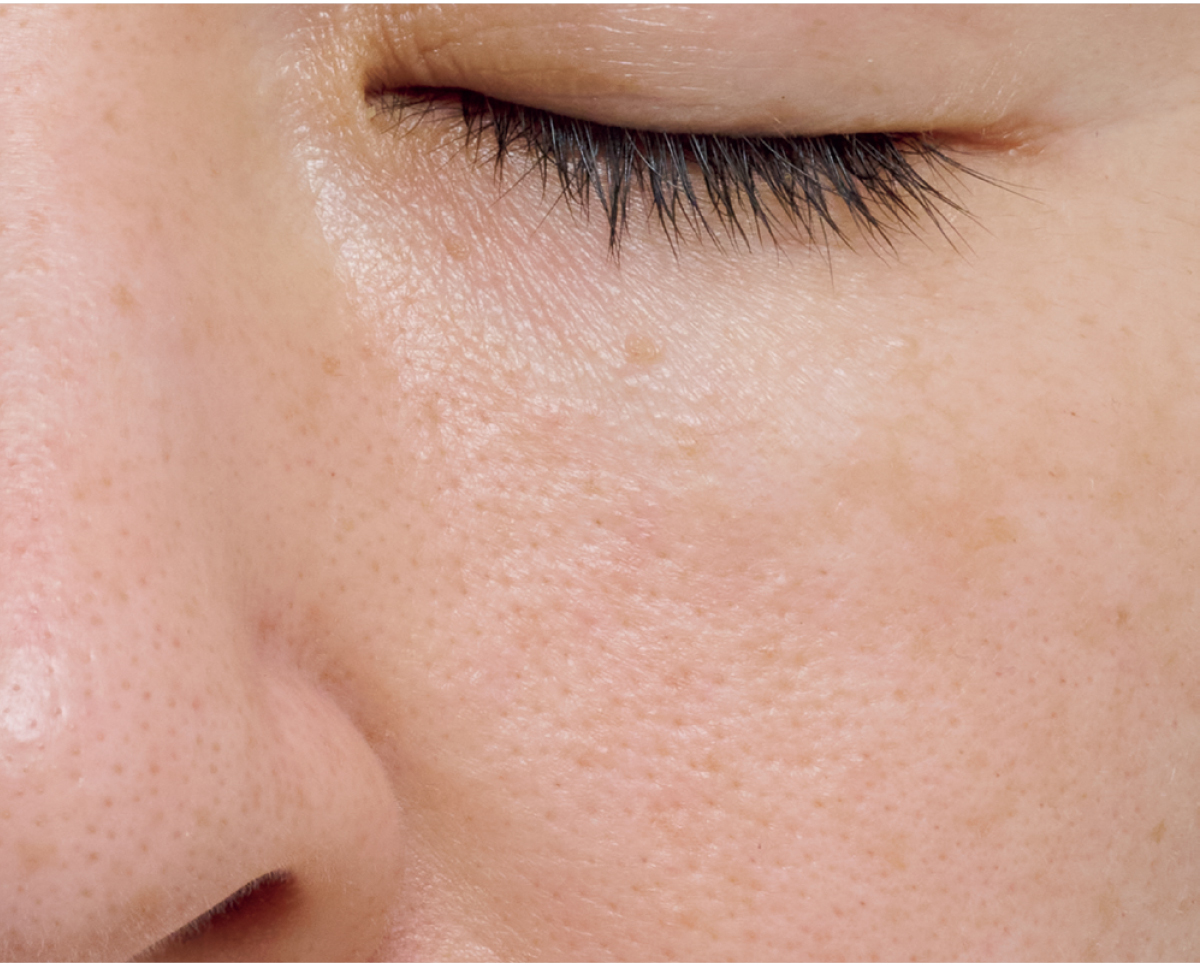 【悩み別】毛穴を目立たなくする方法 PhotoGallery_1_1