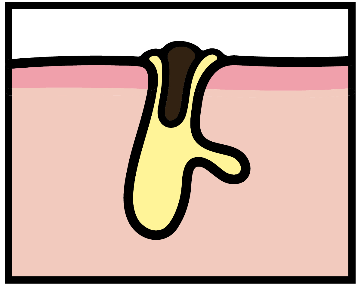 【悩み別】毛穴を目立たなくする方法 PhotoGallery_1_1