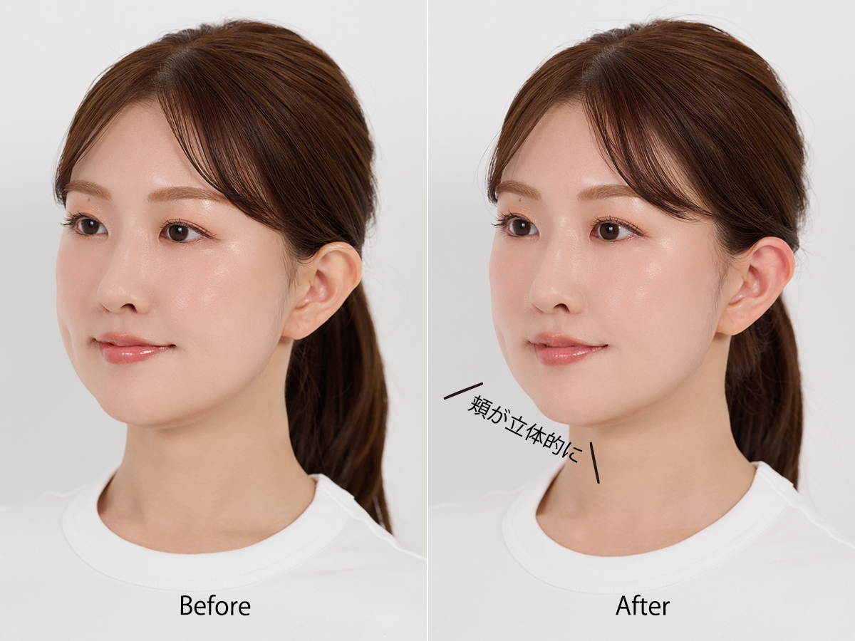 わずか5分ほどで、顔の立体感と血色感がアップ！