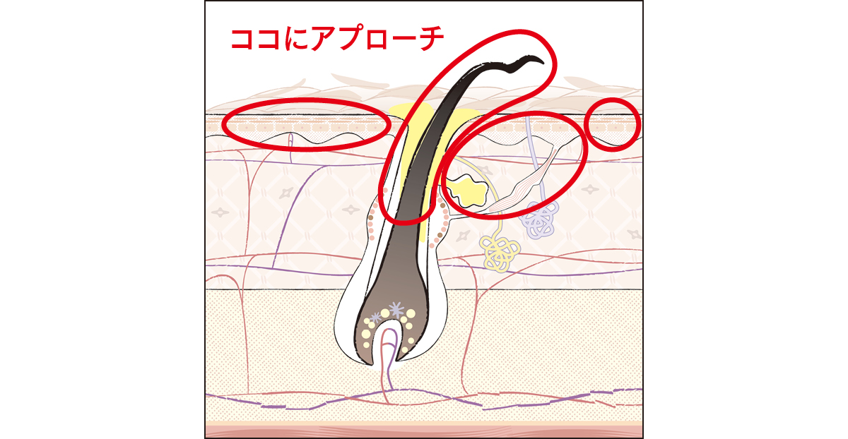 ココにアプローチ