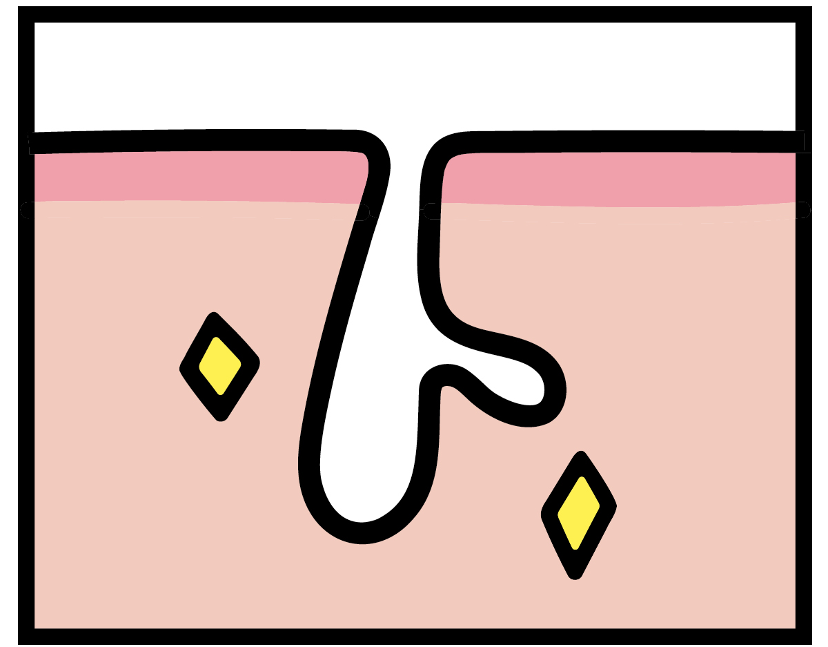 【悩み別】毛穴を目立たなくする方法 PhotoGallery_1_1