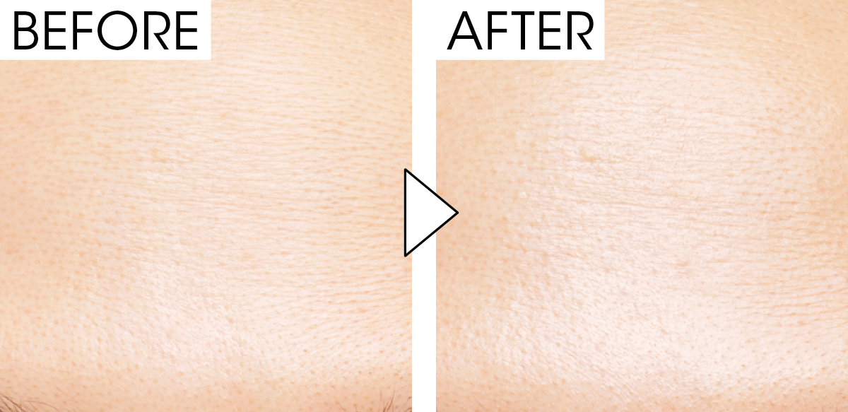 マキア　毛穴ケア　おすすめ　SHISEIDO　エッセンス スキングロウ プライマー