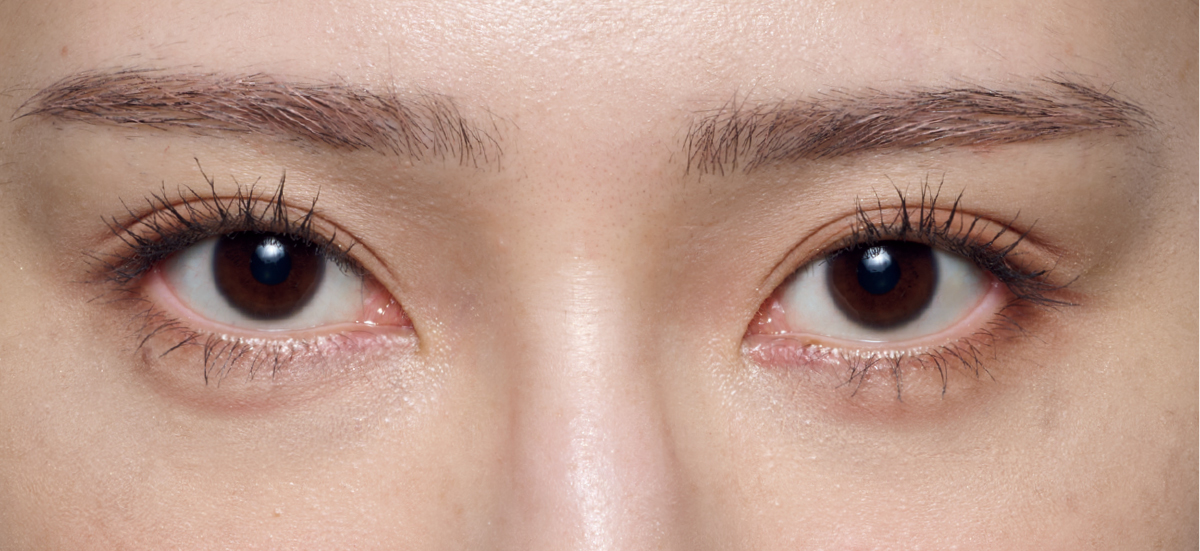 紫ぐまタイプのくまカバー＆涙袋メイクのテクニック アフター