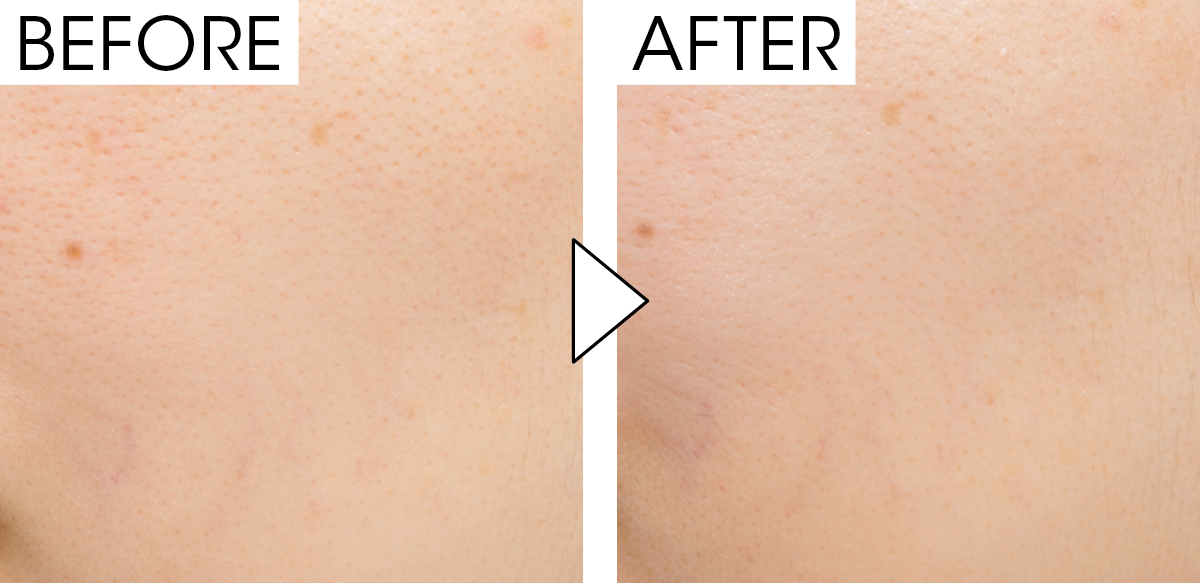 マキア　毛穴ケア　おすすめ ジバンシイ　ソワン ノワール UV コンパクト