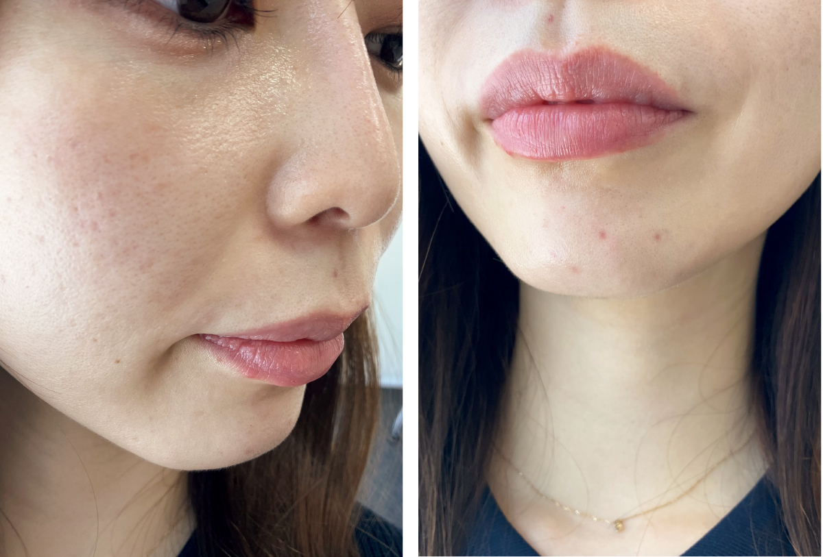 マキア　毛穴　皮脂　スキンケア　肌の状態　4