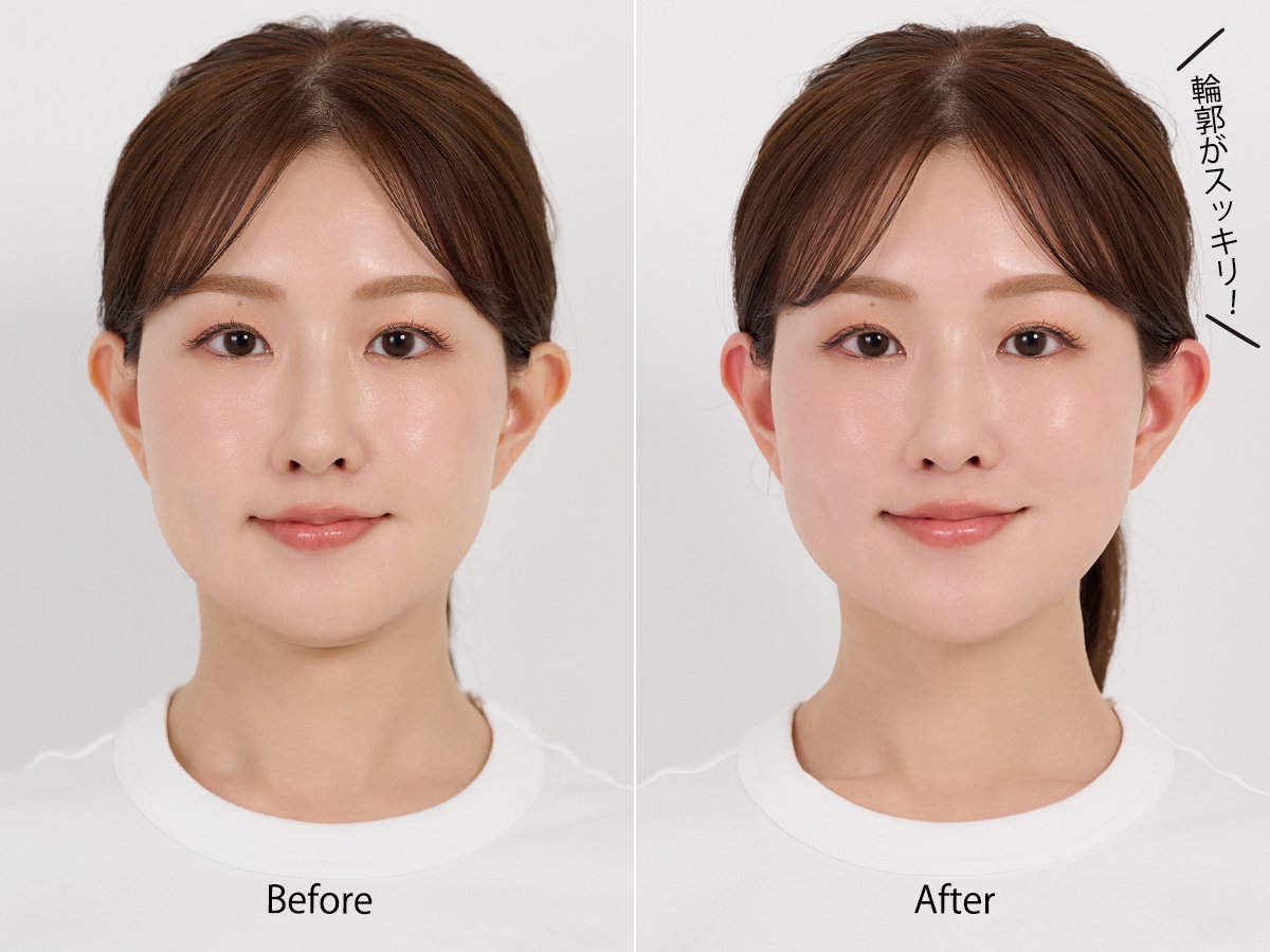 【小顔ストレッチ】たった30秒〜できる