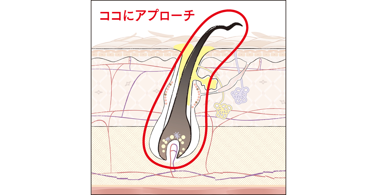 ココにアプローチ