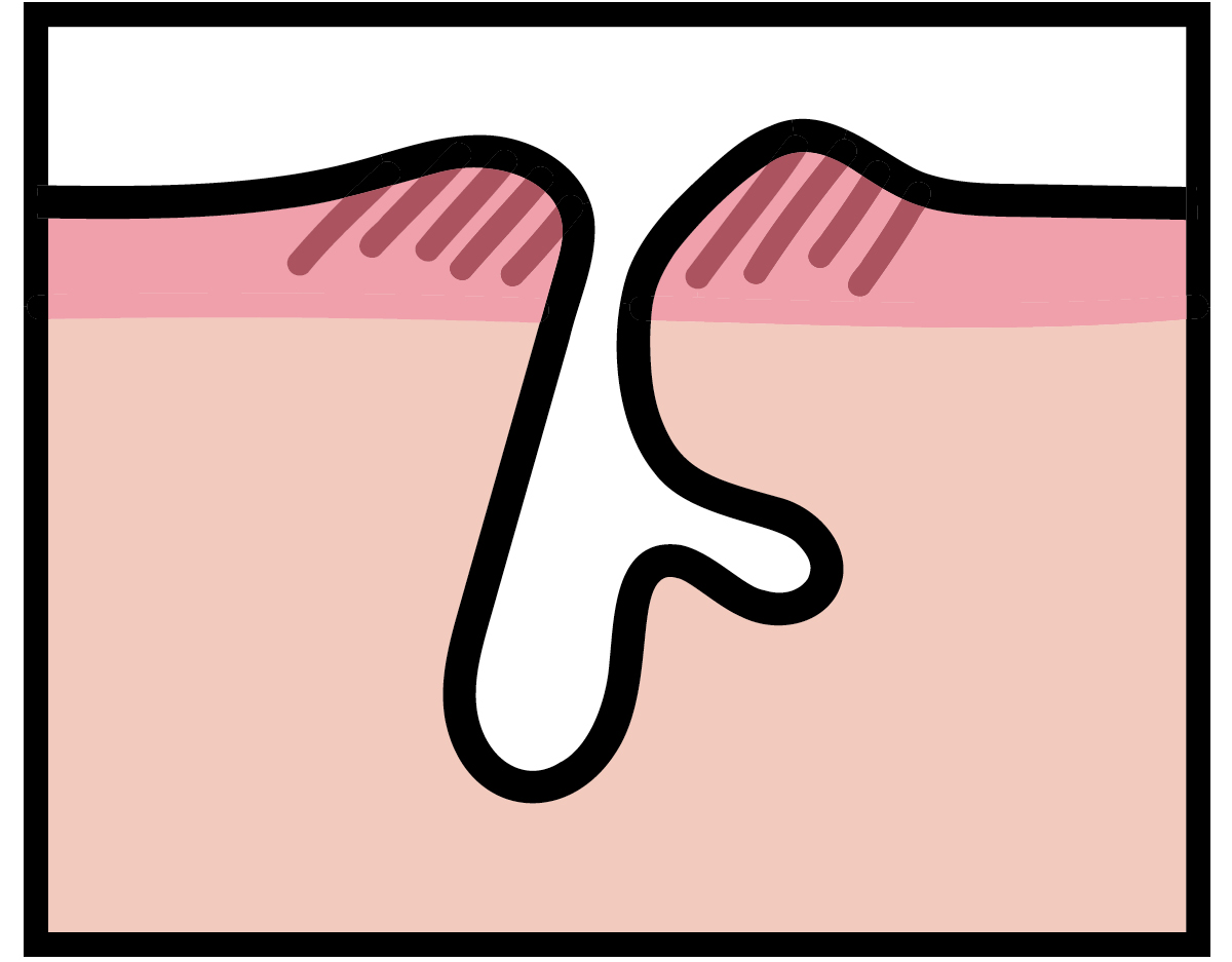 【悩み別】毛穴を目立たなくする方法 PhotoGallery_1_1