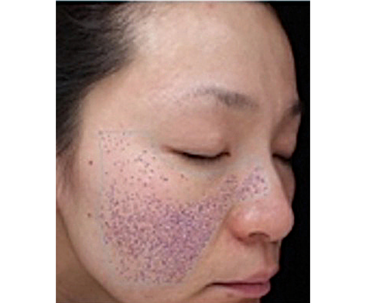 【夏の冷スキンケア】朝・昼・夜におすすめのスキンケアアイテム PhotoGallery_1_1