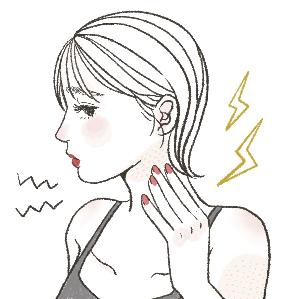 しぶとい「毛孔性苔癬」の対処＆治療法GALLERY_1_1