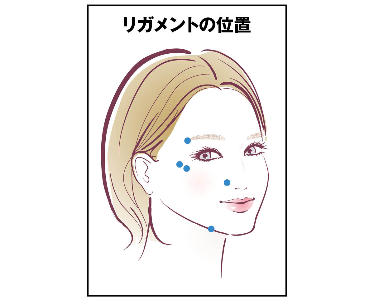 最新美容医療 ヒアルロン酸注入 リガメントの位置