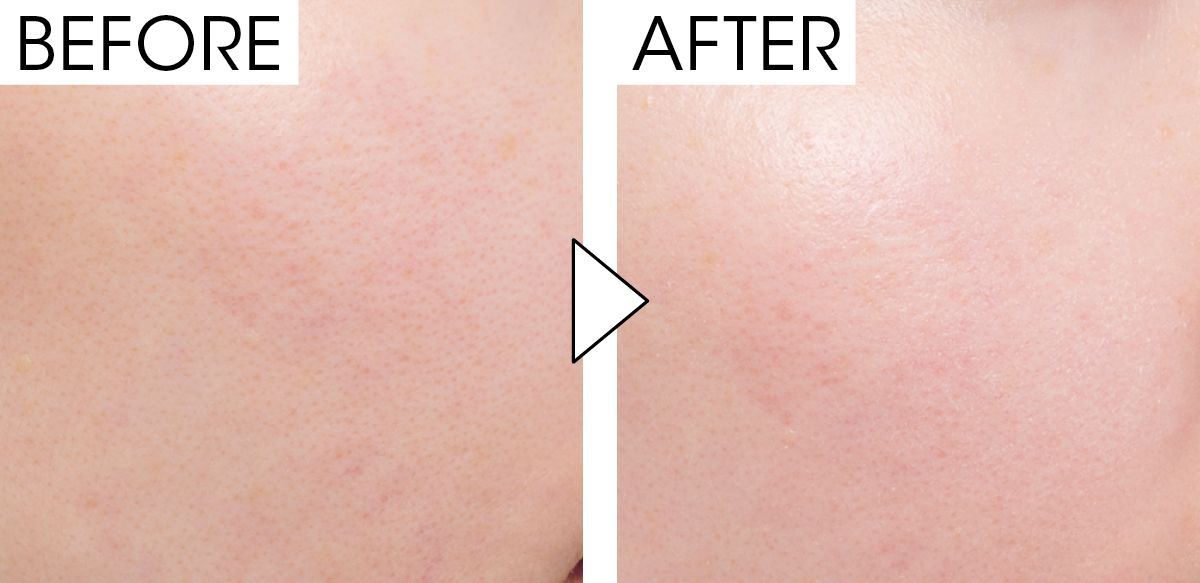 マキア　毛穴ケア　おすすめ　スック　ザ プライマー