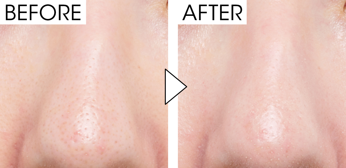 マキア　毛穴ケア　おすすめ　ゲラン　パリュール ゴールド スキン ダブル ヴェール プライマー