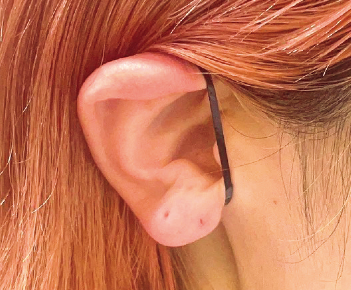 耳ツボ美容の効果は？ ツボの位置を解説 PhotoGallery_1_1