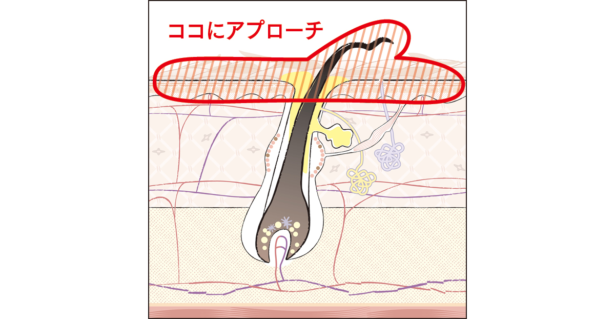 ココにアプローチ