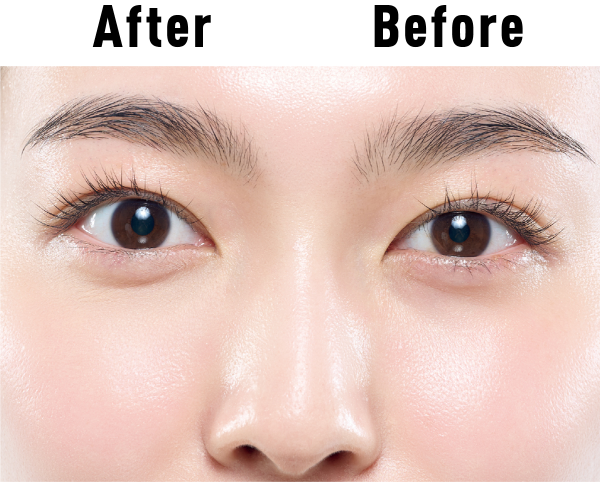 くまカバー ビフォーアフター