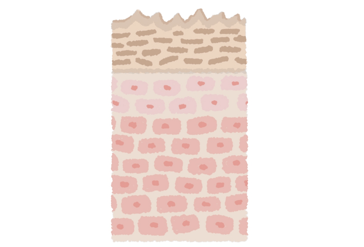 圧迫・摩擦への防御反応で厚く&黒ずんでいく