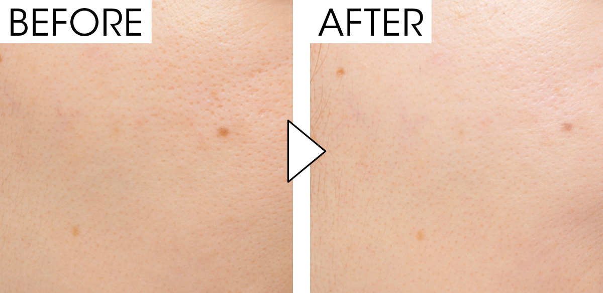 マキア　毛穴ケア　おすすめ　クレ・ド・ポー　ヴォワールルミヌ