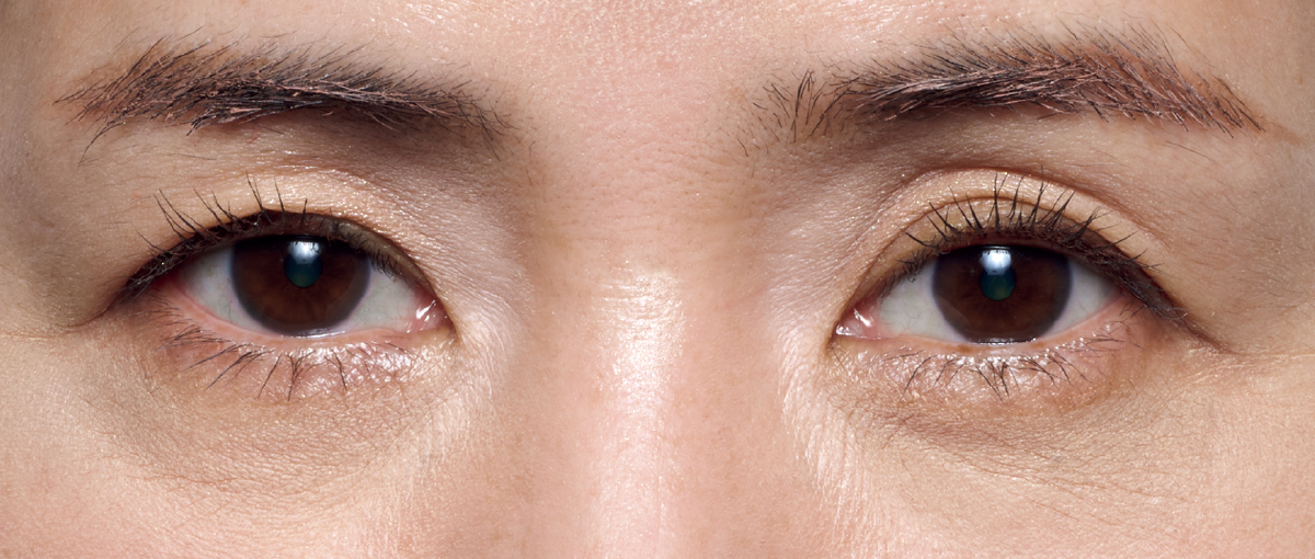 黒ぐま×たるみぐまタイプのくまカバー＆涙袋メイクのテクニック アフター