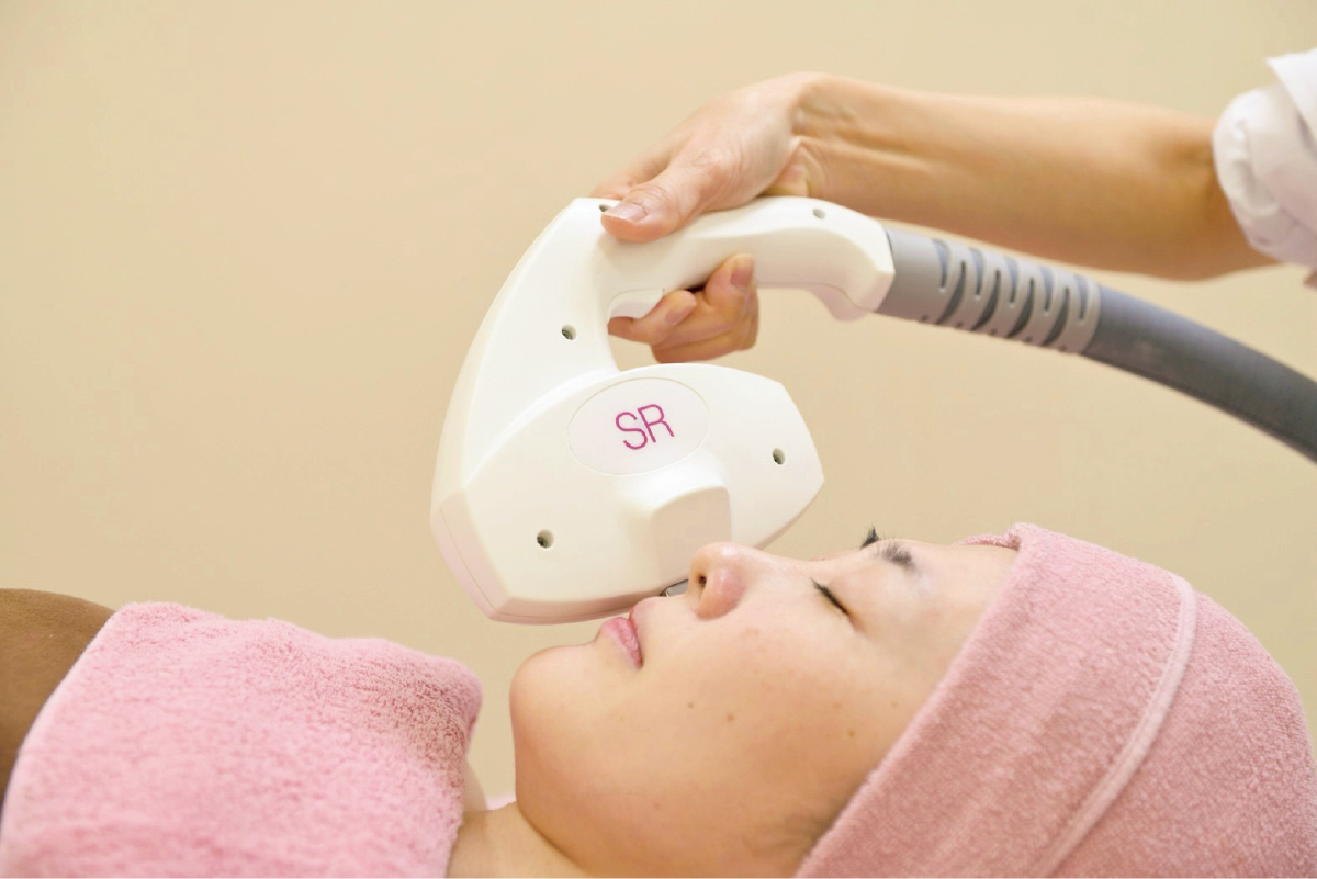 毛細血管赤みにおすすめの美容医療 IPL