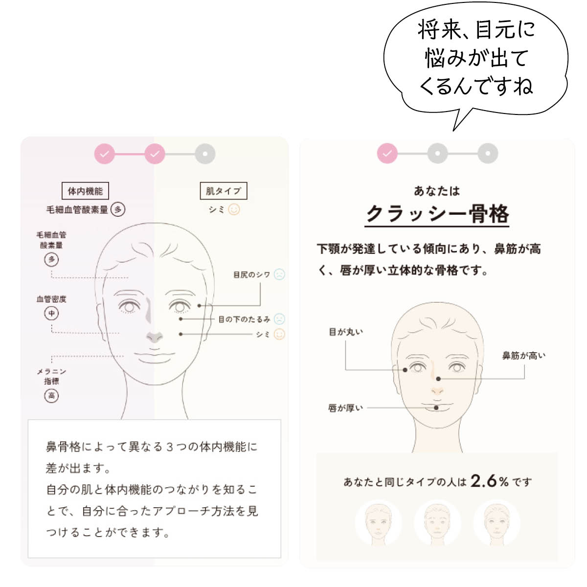 鼻骨格チェック クラッシー骨格タイプ