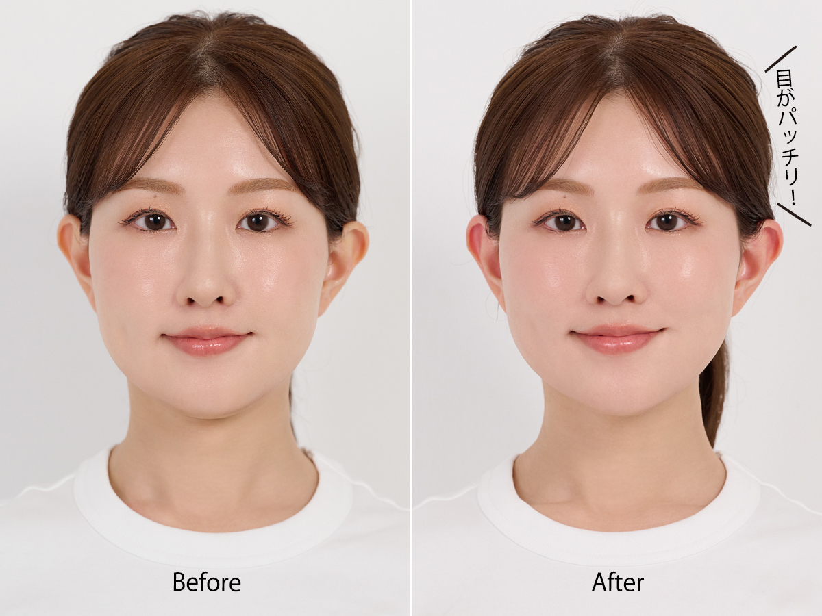 セルフケアで小顔になろう！