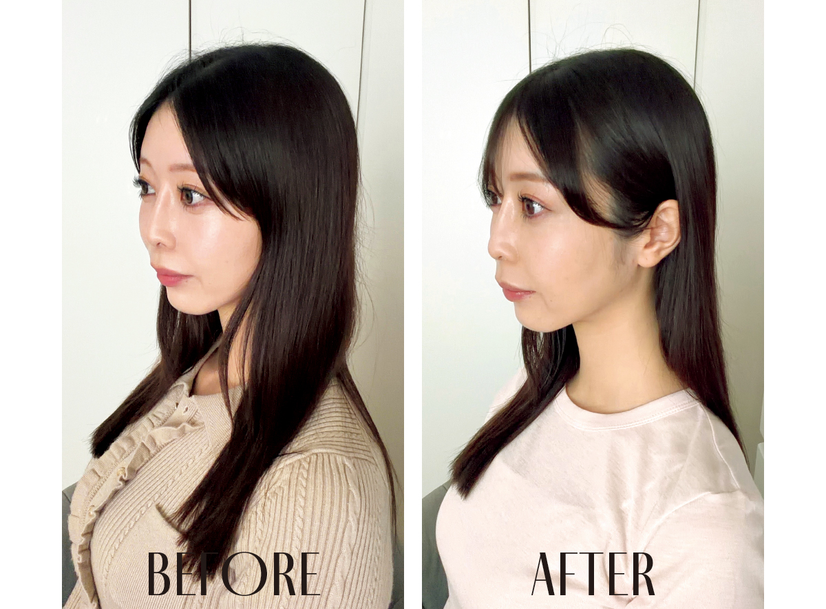 最新おすすめヘアガジェット MYTREX HEAD SPA DEEP Xをお試しレビュー