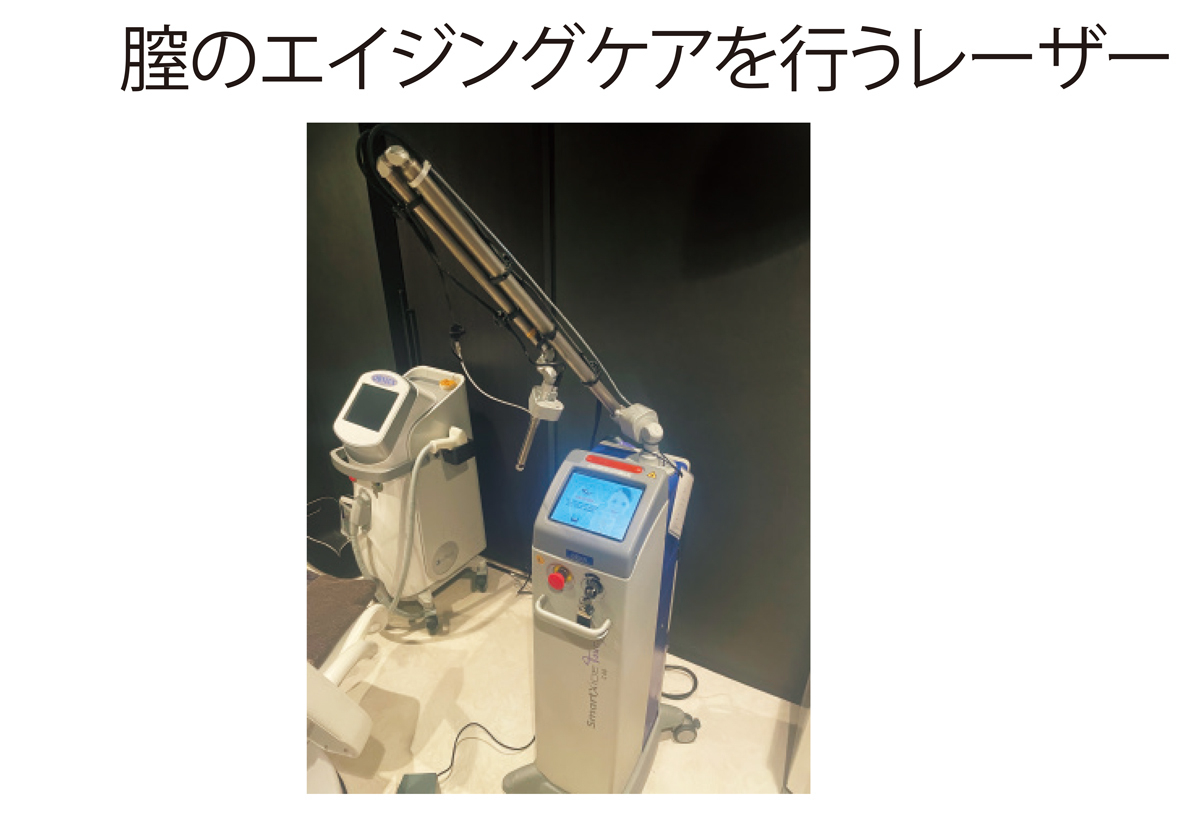 膣のエイジングケアを行うレーザー