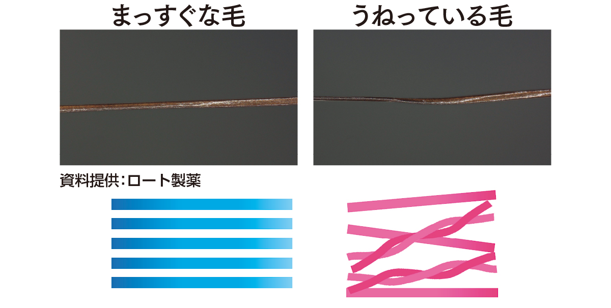 まっすぐな毛　うねっている毛　資料提供：ロート製薬