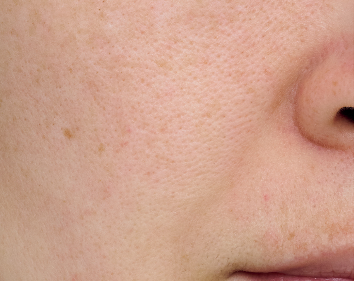 【悩み別】毛穴を目立たなくする方法 PhotoGallery_1_1