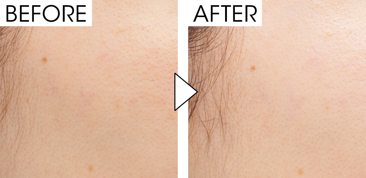 マキア　毛穴ケア　おすすめ　ジョンセンムル スキン セッティング トーン フィルター ベース