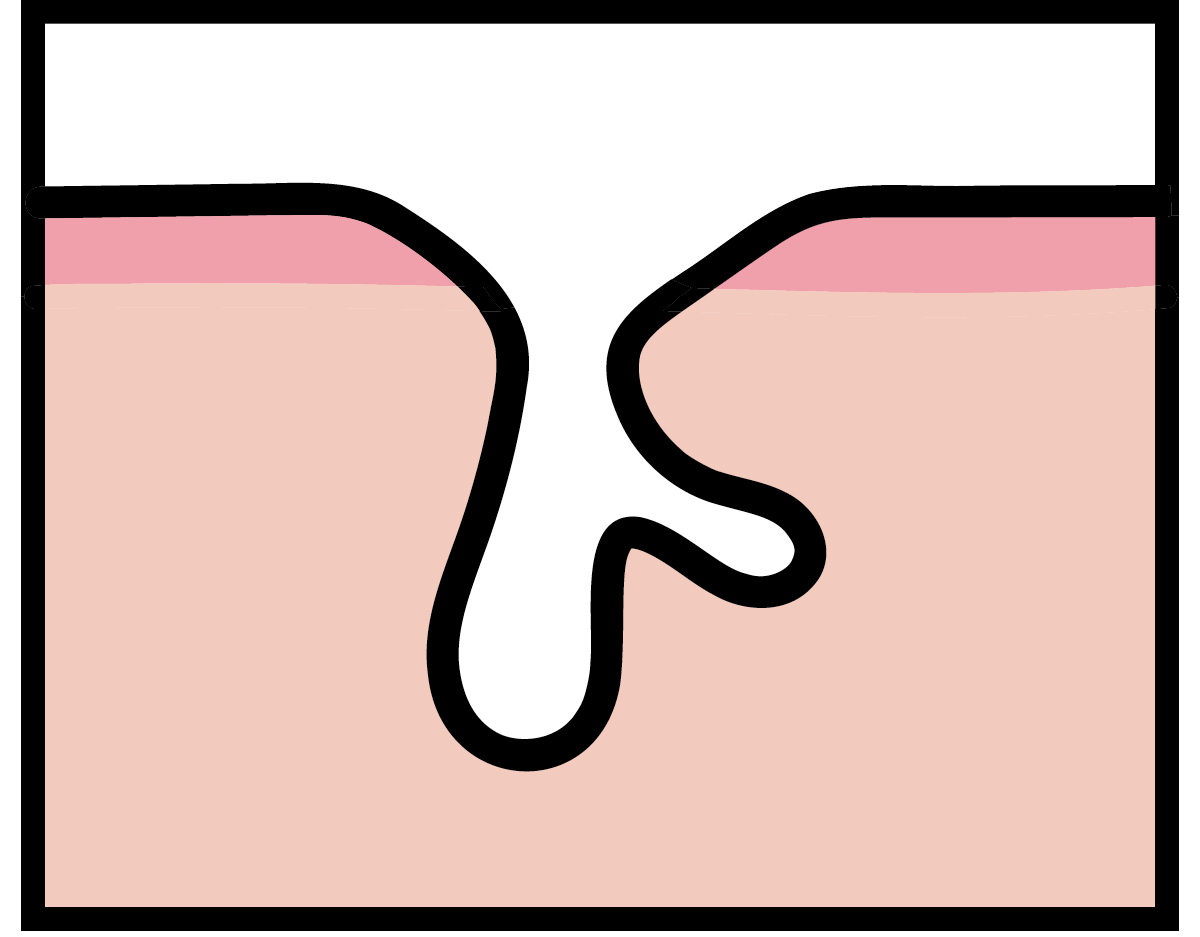 【悩み別】毛穴を目立たなくする方法 PhotoGallery_1_1