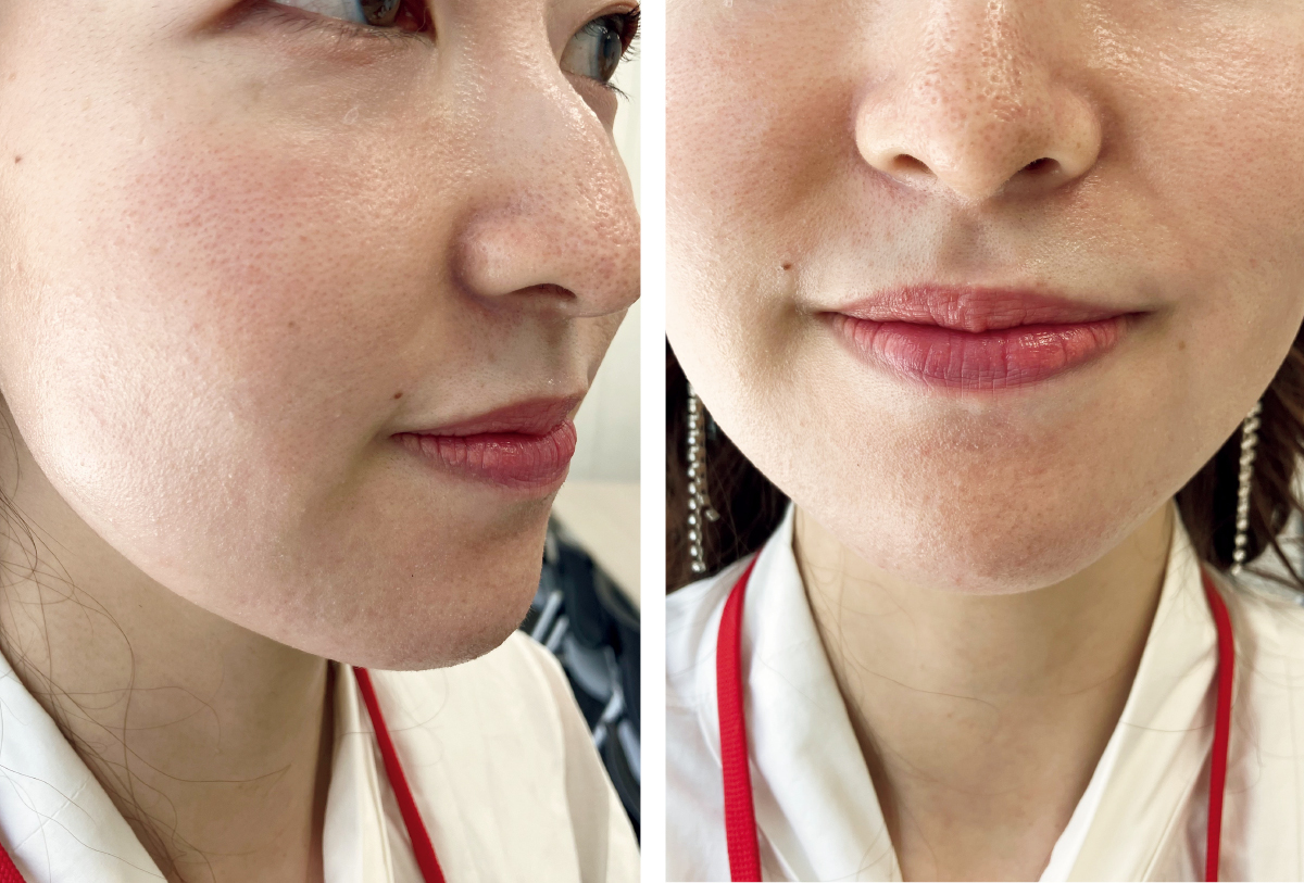 マキア　毛穴　皮脂　スキンケア　肌の状態