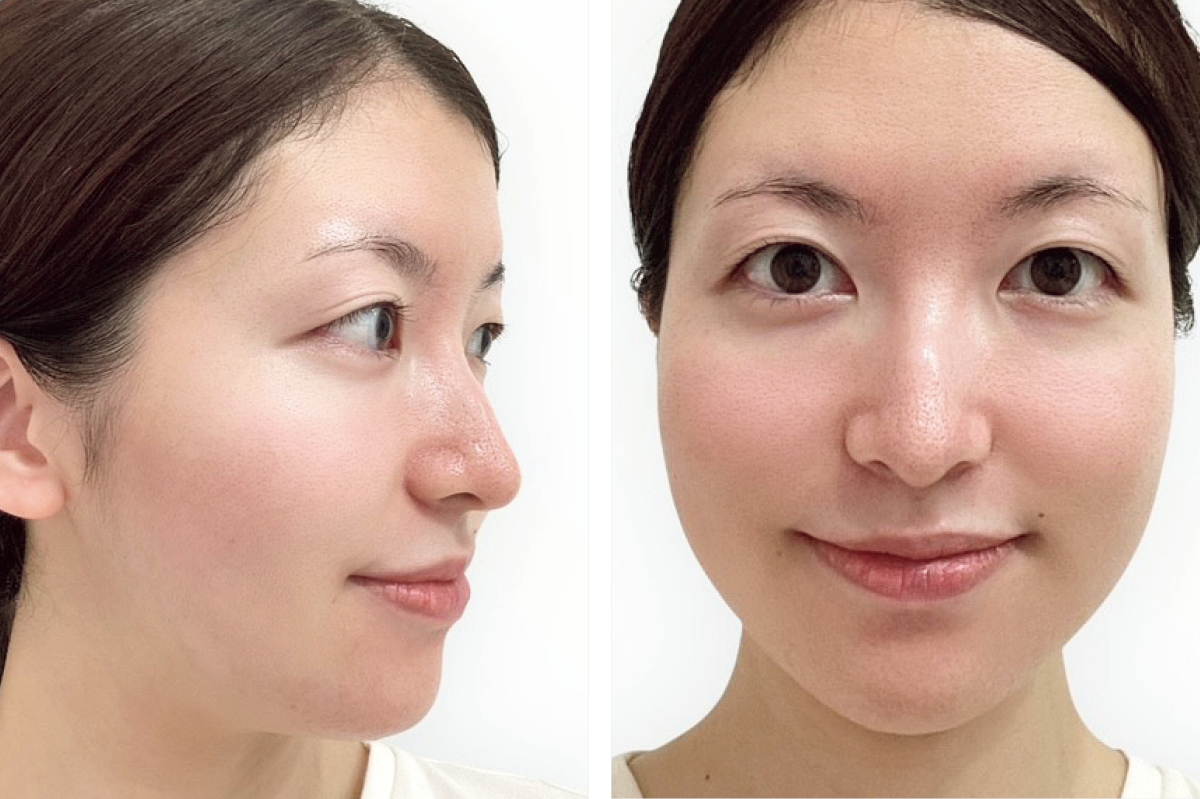 マキア　毛穴　皮脂　スキンケア　肌の状態　3