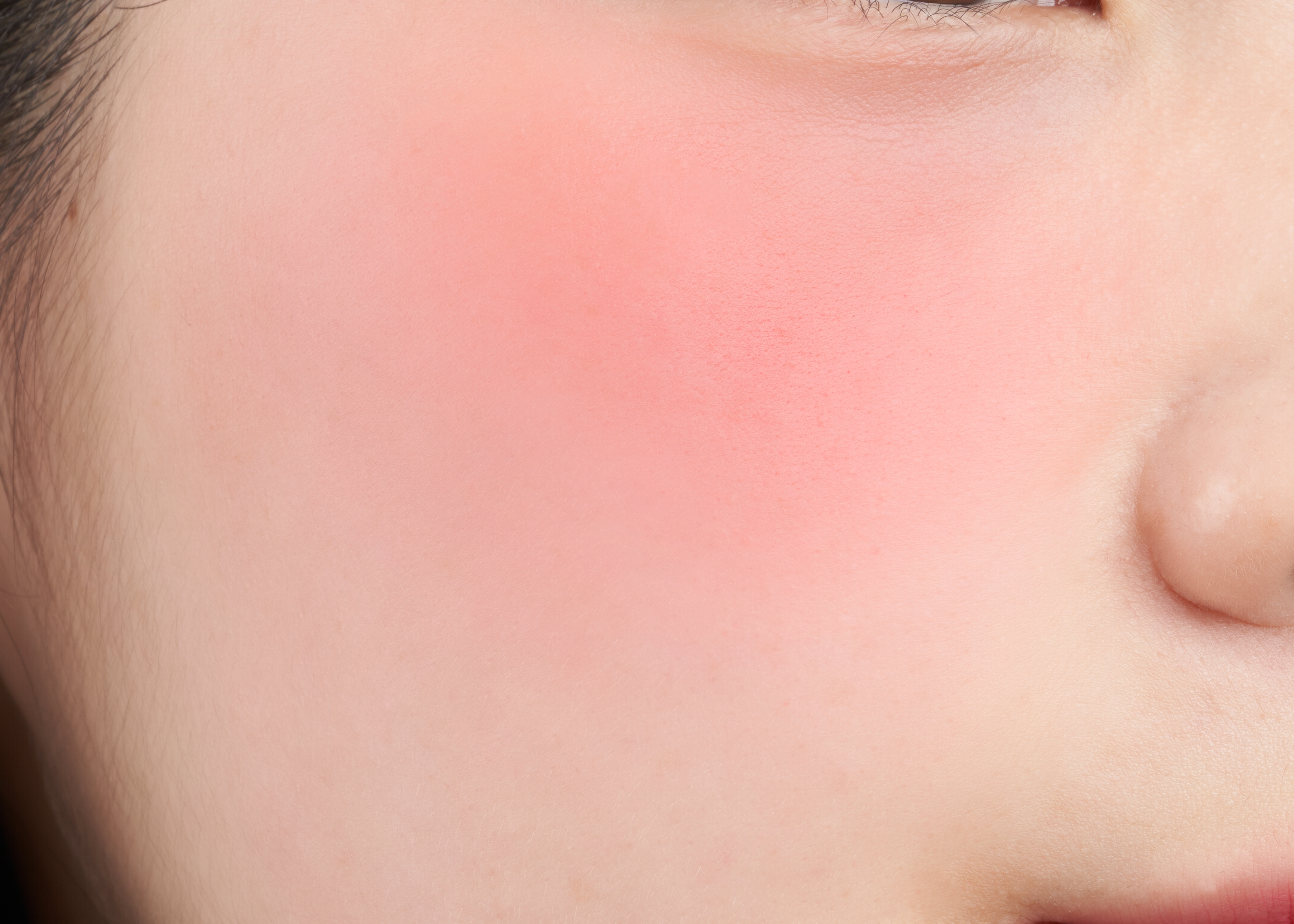 RD03 アンビシャス チーク