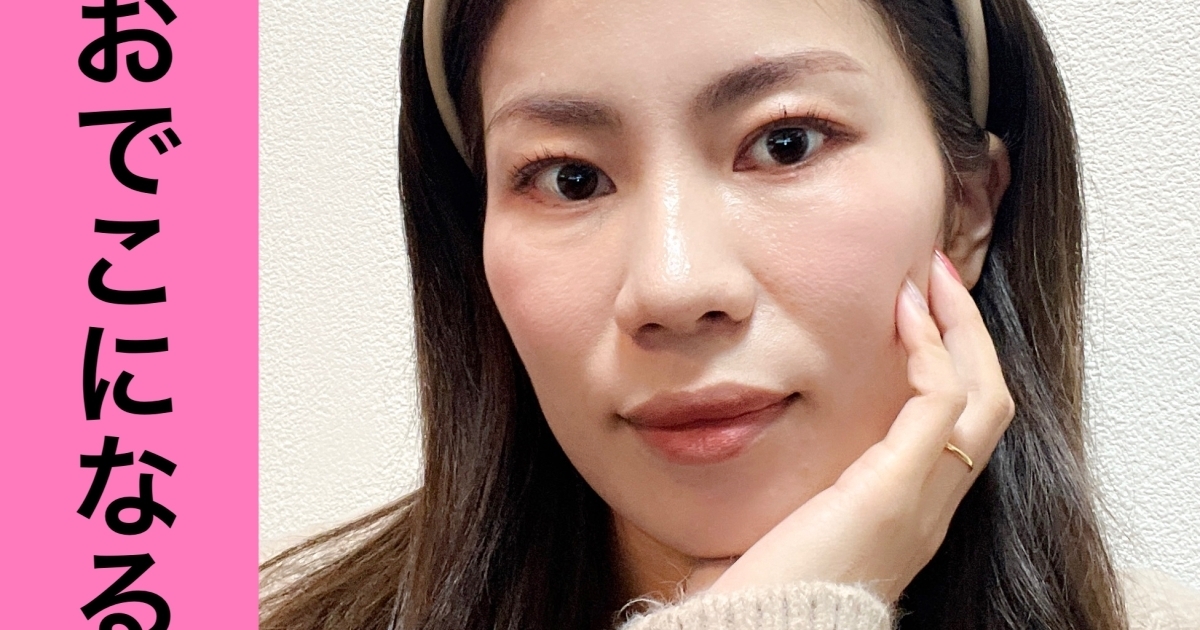 憧れの丸いおでこになった 0円でできる作り方教えちゃいます マキアオンライン Maquia Online