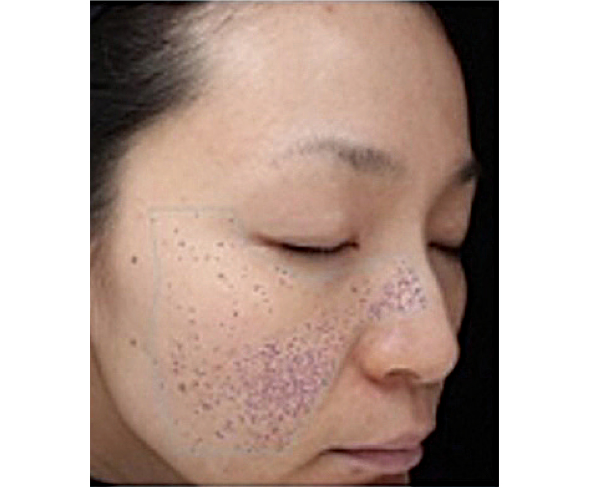 【夏の冷スキンケア】朝・昼・夜におすすめのスキンケアアイテム PhotoGallery_1_1