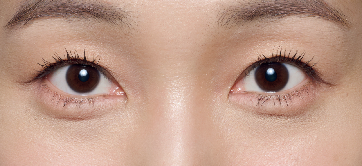 紫ぐま×たるみぐまタイプのくまカバー＆涙袋メイクのテクニック アフター