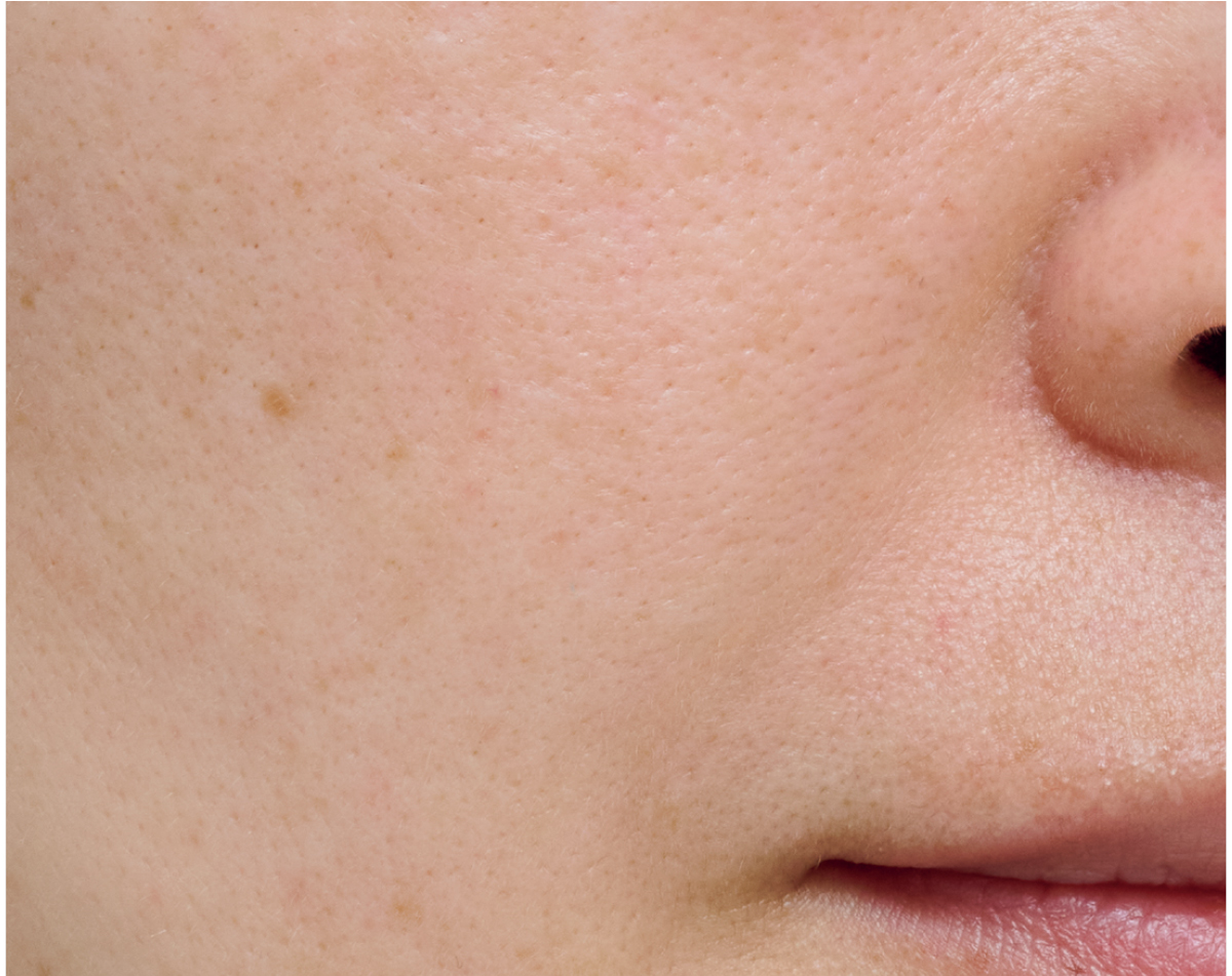 【悩み別】毛穴を目立たなくする方法 PhotoGallery_1_1