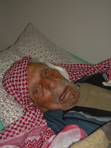 寝たきりになった老人